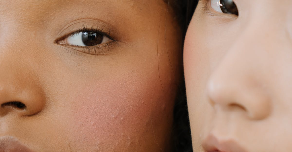 Key Ingredients in Chemical Peels You Should Know